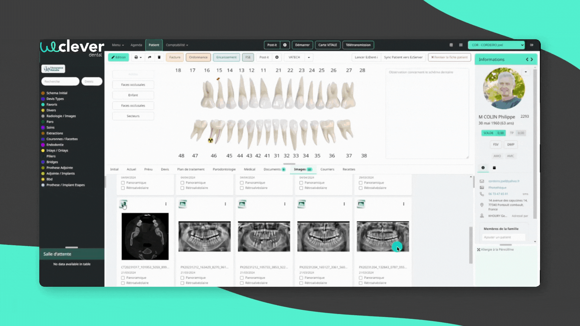 Weclever Dental integration Vatech France
